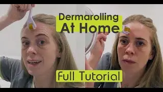 Dermarolling At Home - Full Tutorial & Why You Should Do It!