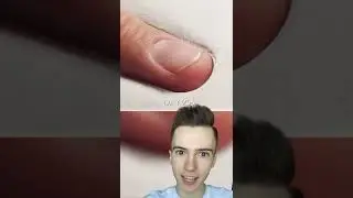 Как растёт ноготь... 