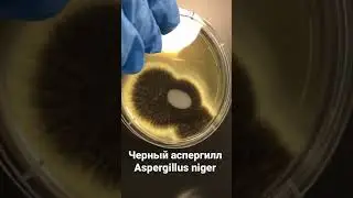 Культура черного аспергилла на чашке Петри - Aspergillus niger