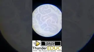 Testes under a microscope thundereduc m.saidi- THUNDEREDUC