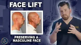 The Male Facelift: Facial Rejuvenation Surgery for Men