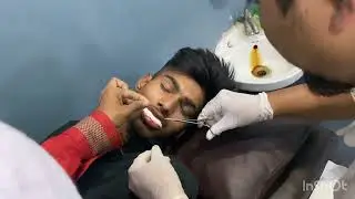 Road Accident took 3 sutures on the lower lip|| 4-0