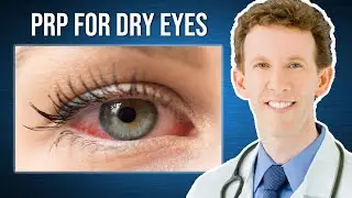PRP Treatment for Dry Eyes with Dr. Scheiner | Carolyn's Testimonial