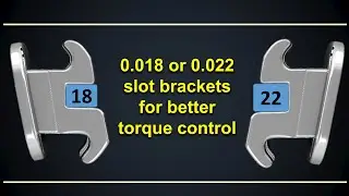 0.018 or 0.022 slot brackets for better torque control