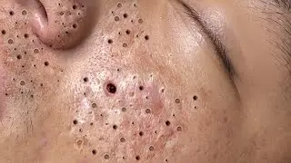 Relaxing Everyday With Loan Nguyen Skincare
