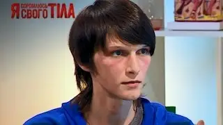 К врачам обратился человек неопределенного пола - Я соромлюсь свого тіла - 02.04.15