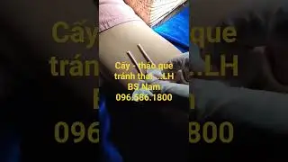 Tháo - Cấy que tránh thai BS.Nam  Hưng Yên 096.586.1800