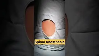 How to Give Spinal Anesthesia | OT | Surgery | Anesthesia |