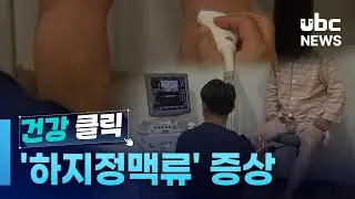 혈관이 울퉁불퉁 '하지정맥류'  증상과 예방법은 240908