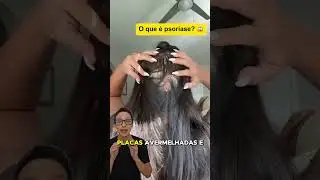 Psoríase 😱 