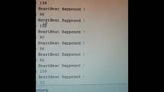Arduino Uno based heart beat sensor 