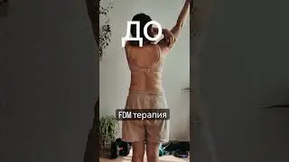 FDM терапия #FDM #лечение #боль #рука #плечо #доипосле #немогу #фасция #манипуляции #санктпетербург