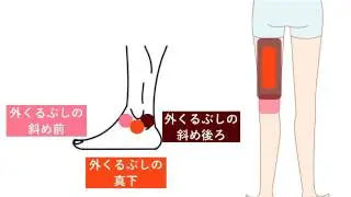 ハムストリングスが硬い意外な原因