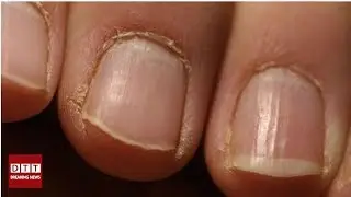 Vous avez des cuticules ? Voici comment les éliminer !