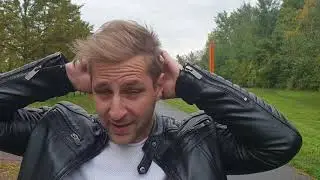 2 YEARS after my 2 Hair Transplant - the REAL RESULT