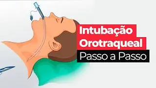Intubação Orotraqueal PASSO A PASSO