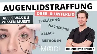 Bist du für eine Oberlidstraffung oder Unterlidstraffung geeignet? - Dr. Christian Wolf
