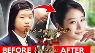 بازیگرای کره ای که با عمل زیبایی از لولو تبدیل به هلو شدن 😨