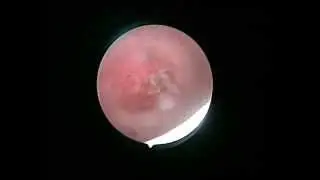 Vaginoscopy tips and tricks by Osama Shawki