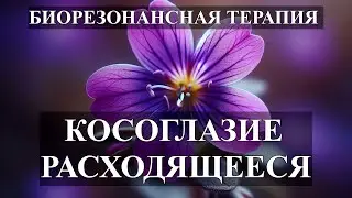 Косоглазие Расходящееся💎Биорезонансная Терапия БРТ🎧Strabismus Divergent💎Bioresonance Therapy BRT