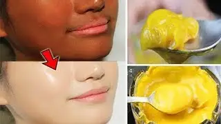 Skin Whitening Used Turmeric Gel on my Face & it removed Dark Spots | Visible Fair Skin in 2 days