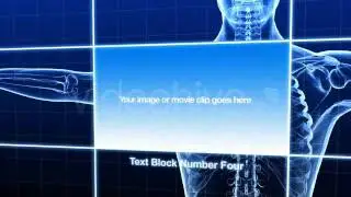 3D Medical Animation with After Effects