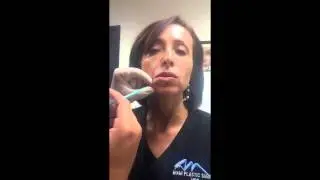 Botox and Restylane for Lower Facial Rejuvenation
