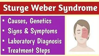 Sturge Weber Syndrome (SWS) Causes, Signs & Symptoms, Diagnosis and Treatment
