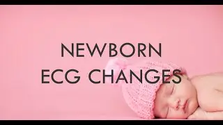 Understanding ECG Changes in Newborns: A Detailed Overview.