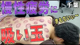 【吸い玉 慢性疲労 整体】フリーランス柔整師も身体がボロボロ・・・お疲れの体を吸い玉で改善！！