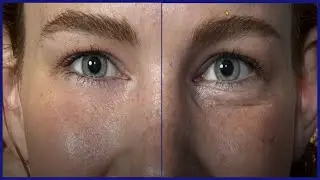Remove Wrinkles Under Eyes Photoshop 🎨 Eliminate bags, lines and Blemishes