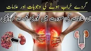 What Are The Causes and Symptoms Of Kidney Failure | Kidney Pain Location in urdu | Lower Back Pain