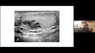 infertility  cases with Dr.Abumelha