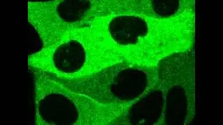 oscillations of GFP-PKCbetaII in HeLa cells induced by UTP