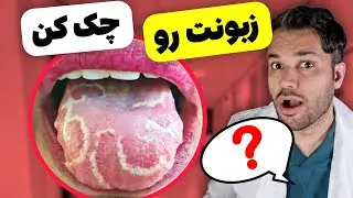 میشه از روی زبان بیماری ها رو تشخیص داد؟