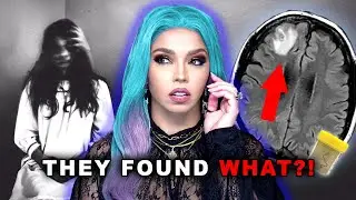 This was GROWING in her BRAIN?!... Disturbing true stories