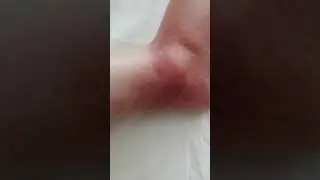 Травмировал бывший парень Павла Ясносвета.