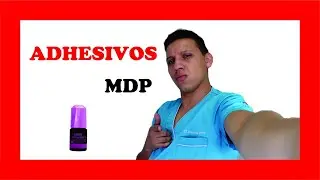 ¿Cuál es la mejor técnica adhesiva? (Generaciones de adhesivos dentales)
