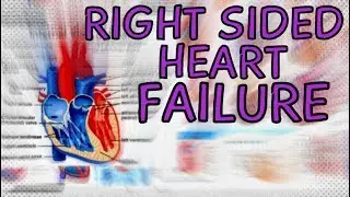 Right Sided Heart Failure - Explained in 2 Minutes  (Right Ventricle Failure)