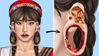 ASMR Remove Worm & Maggot Ear Infected | Severely Injured Animation