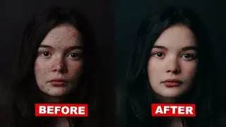 How to Quickly Smooth Skin and Remove Blemishes & Scars in Photoshop 