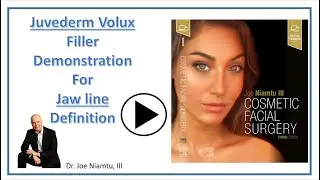 Juvederm Volux Demonstration for jaw line enhancement