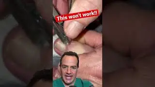 DOCTOR REACTS: HOW TO NOT REMOVE AN INGROWN TOENAIL! 