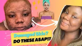 Do These 5 Skincare Tips Now!! They Will Change Your Life!
