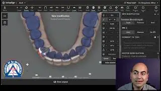 Monday Tip: Clincheck Modifications for your Invisalign Cases.