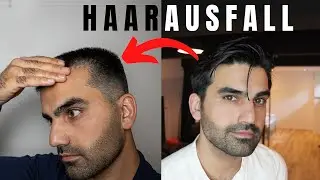 Kampf gegen den Haarausfall: Meine persönliche Erfahrung