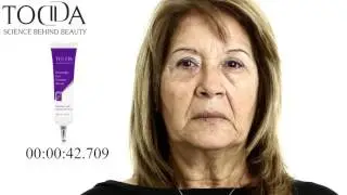 קמטים במצח? קמטים בפנים? תוך 10 דקות 10 שנים פחות ל 10 שעות!