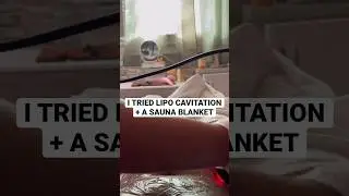 I Tried Lipo Cavitation + A Sauna Blanket