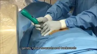 DISKOM™ - Percutaneous discectomy probe: live surgery with Dr. Masala