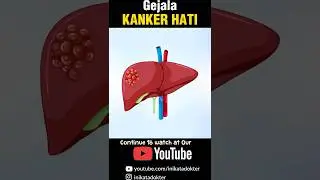 Gejala Kanker Hati #kesehatan #inikatadokter